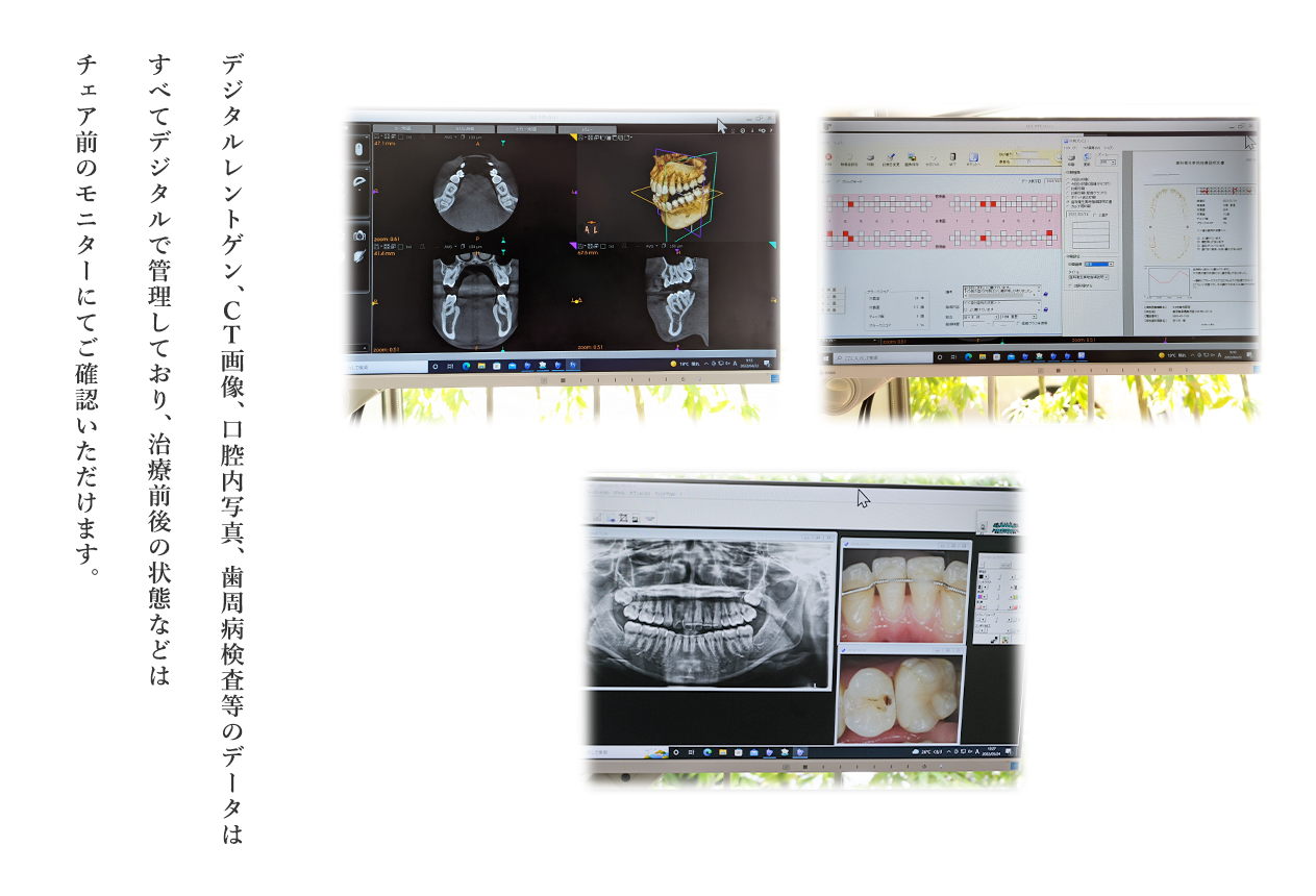 デジタルレントゲン・CT・歯周病検査データ