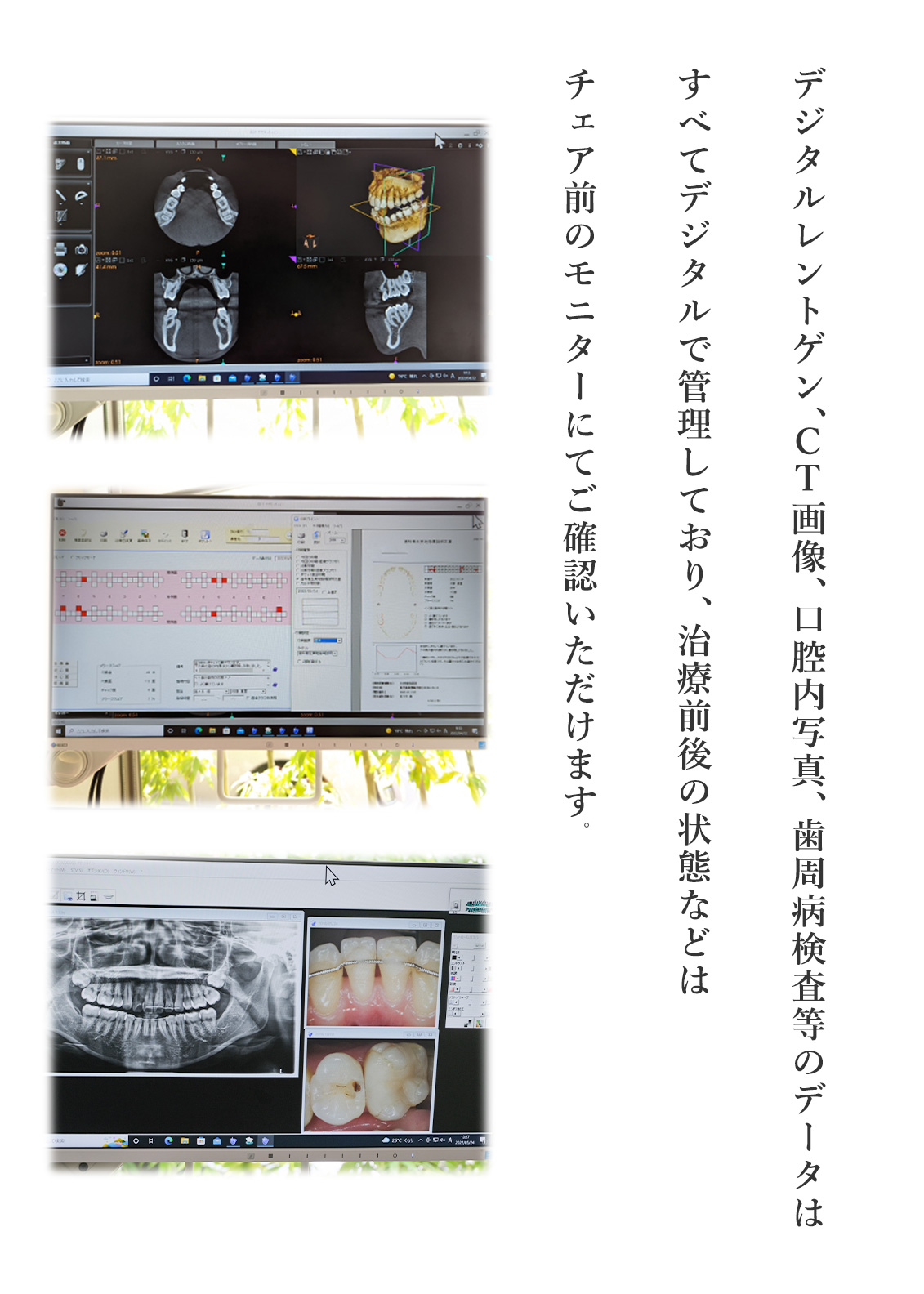 デジタルレントゲン・CT・歯周病検査データ